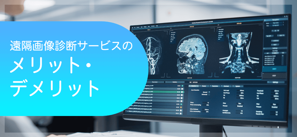 遠隔画像診断サービスのメリット・デメリットの見出し画像